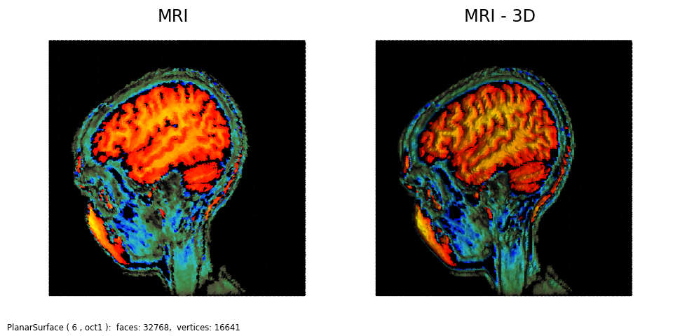 ../../_images/mri1.png