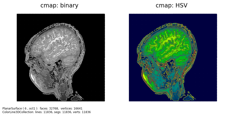 ../../_images/mri_contours1.png