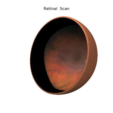 ../_images/retinal_scan.png