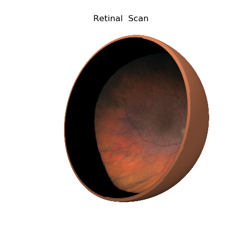 ../../_images/retinal_scan1.png